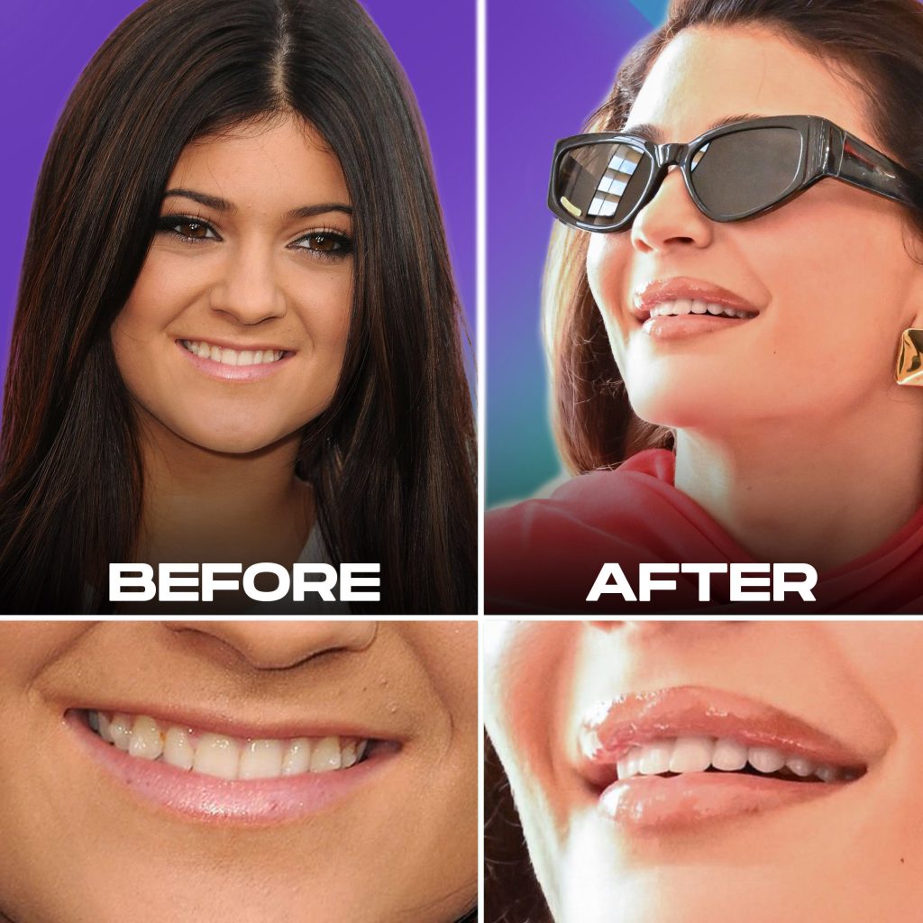 Kylie Jenner’s Secret Smile: Your Transformative Guide